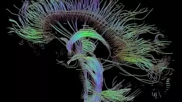 神經科學新技術─ 如何解開大腦的神祕訊息？